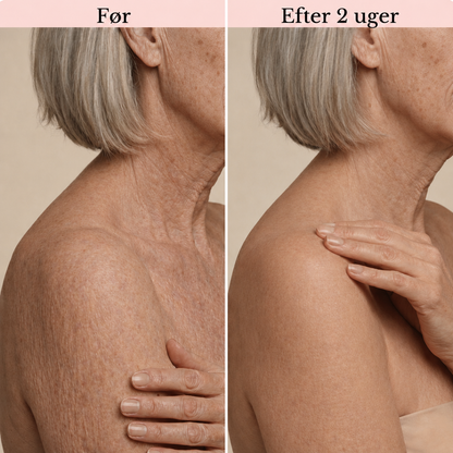 PureDerm Retinol Body Lotion